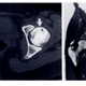 Image for article titled Could Modern Medicine Have Saved Bo Jackson's Career?